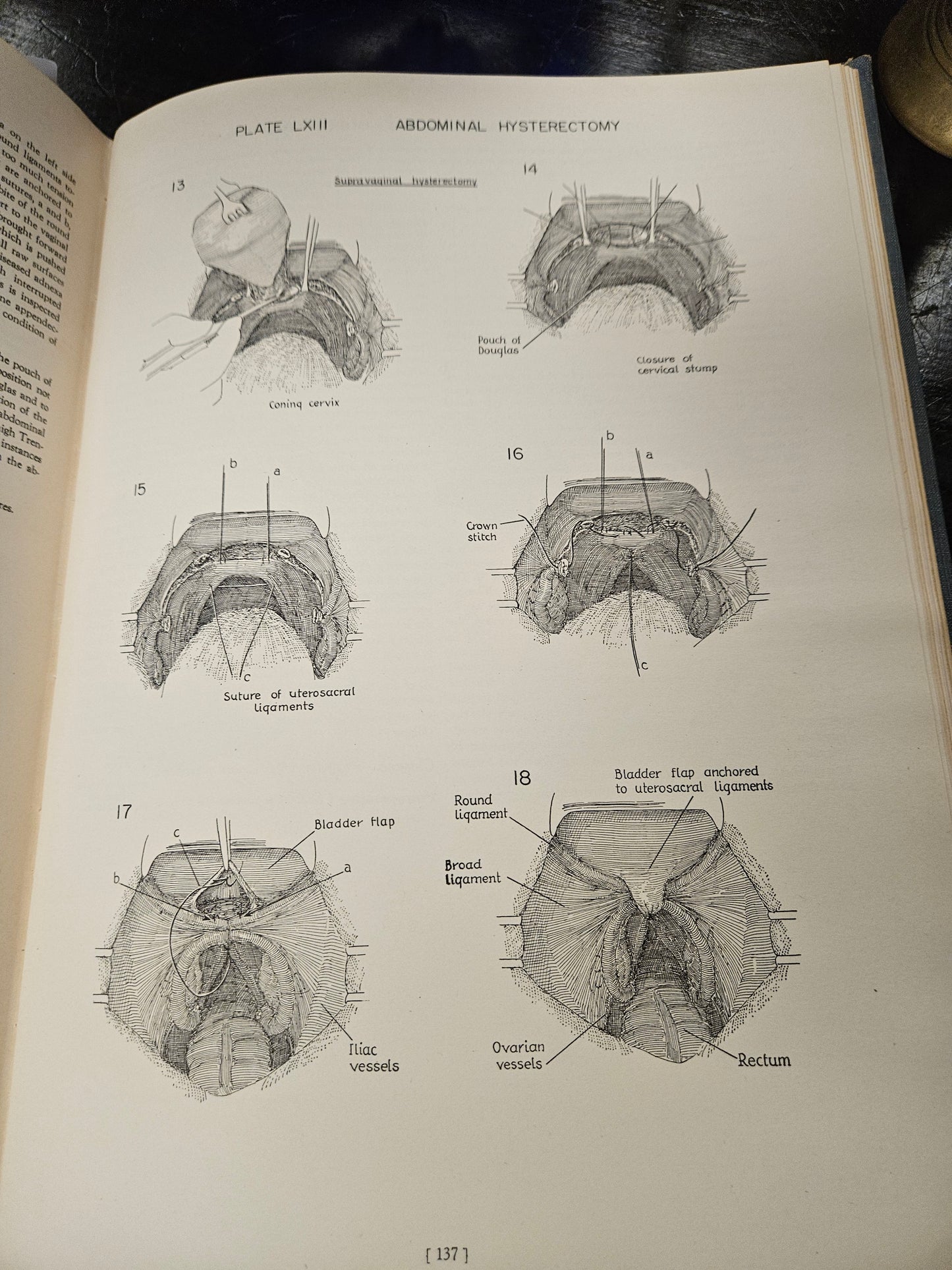 vintage blue ATLAS OF SURGICAL OPPERATIONS medical book