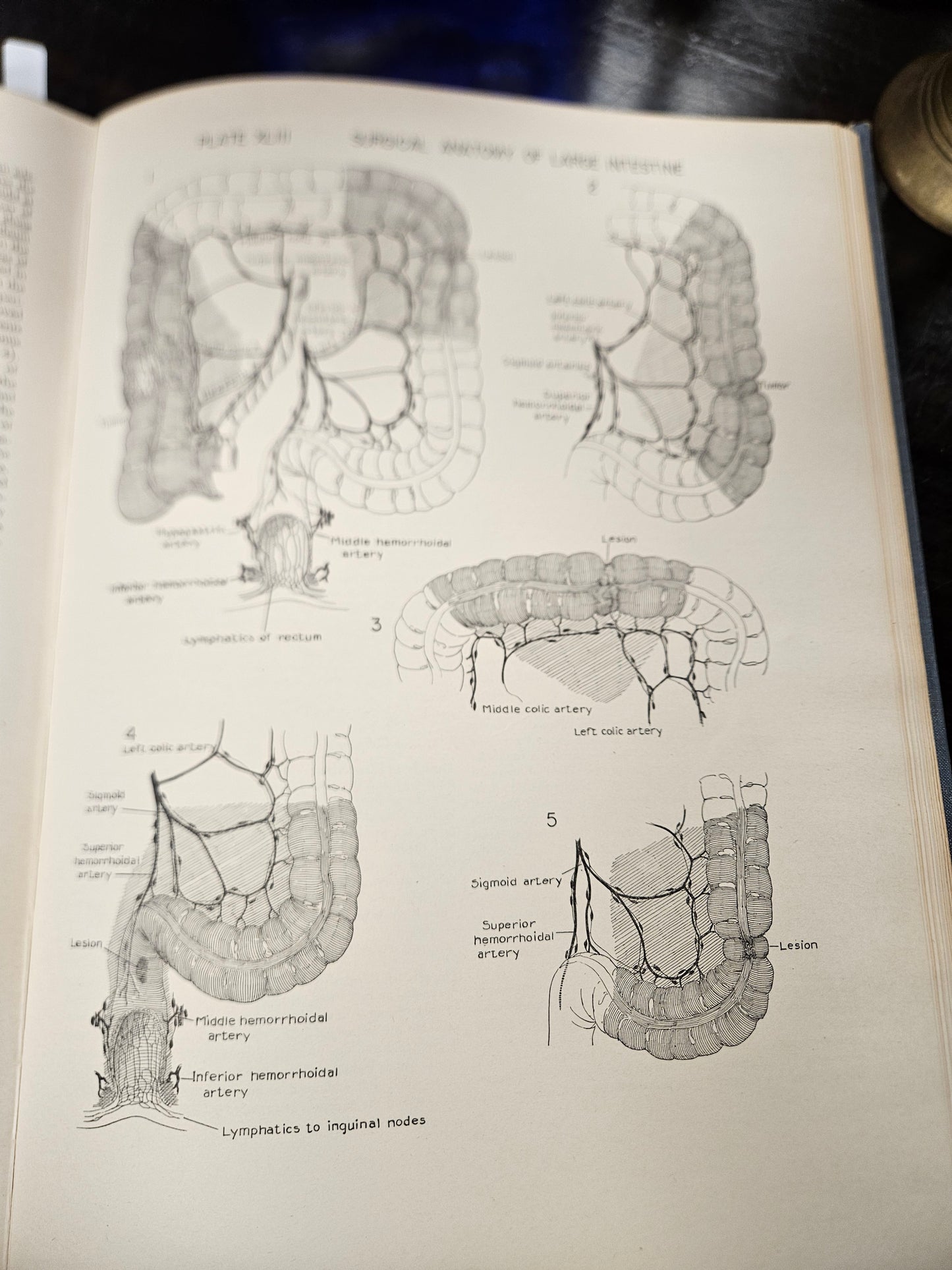 vintage blue ATLAS OF SURGICAL OPPERATIONS medical book